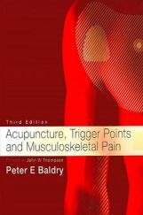 Acupuncture Trigger Points and Musculoskeletal Pain 