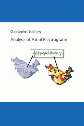 Analysis Of Atrial Electrograms