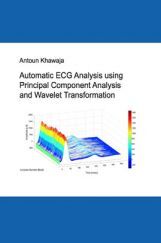 Automatic ECG Analysis Using Principal Component Analysis