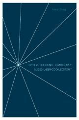 Optical Coherence Tomography Guided Laser Cochleostomy