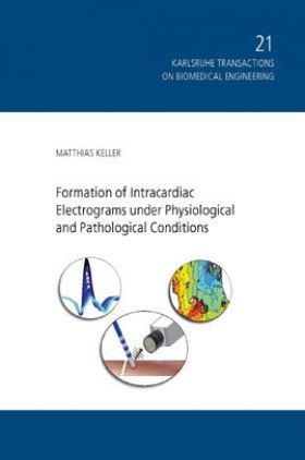 Formation Of Intracardiac Electrograms Under Physiological