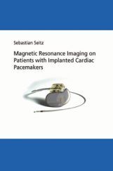 Magnetic Resonance Imaging On Patients With Implanted Cardiac Pacemakers Magnetic Resonance Imaging On Patients With Implanted Cardiac Pacemakers