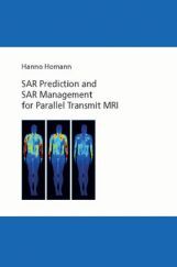 SAR Prediction And SAR Management For Parallel Transmit MRI SAR Prediction And SAR Management For Parallel Transmit MRI