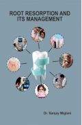 Root Resorption And Its Management Root Resorption And Its Management
