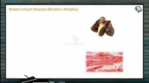 Body Fluids And Circulation - Other Heart Defects And Disorders (Session 12)