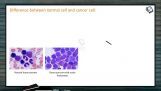 Human Health And Diseases - Difference Between Normal And Cancer Cell (Session 5) Human Health And Diseases - Difference Between Normal And Cancer Cell (Session 5)