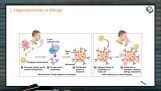 Human Health And Diseases - Hypersensitivity Or Allergy (Session 3) Human Health And Diseases - Hypersensitivity Or Allergy (Session 3)
