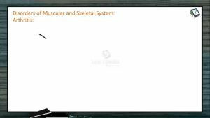 Locomotion And Movement - Disorders Of Skeletal System (Session 8)