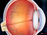 Grade X Presbyopia Grade X Presbyopia