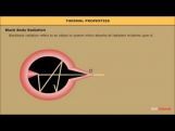 Class 11 Physics - Thermal Radiation Video by MBD Publishers Class 11 Physics - Thermal Radiation Video by MBD Publishers